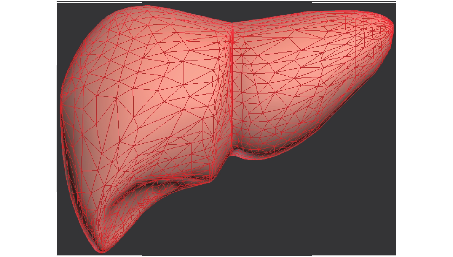 由3ds max建立的肝脏模型